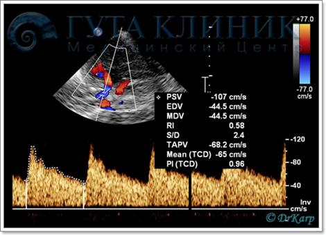 дуплексное сканирование